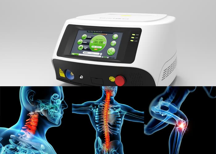 30 Watts Laser Pain Relief Machine For Knee Pain _ Arthritis